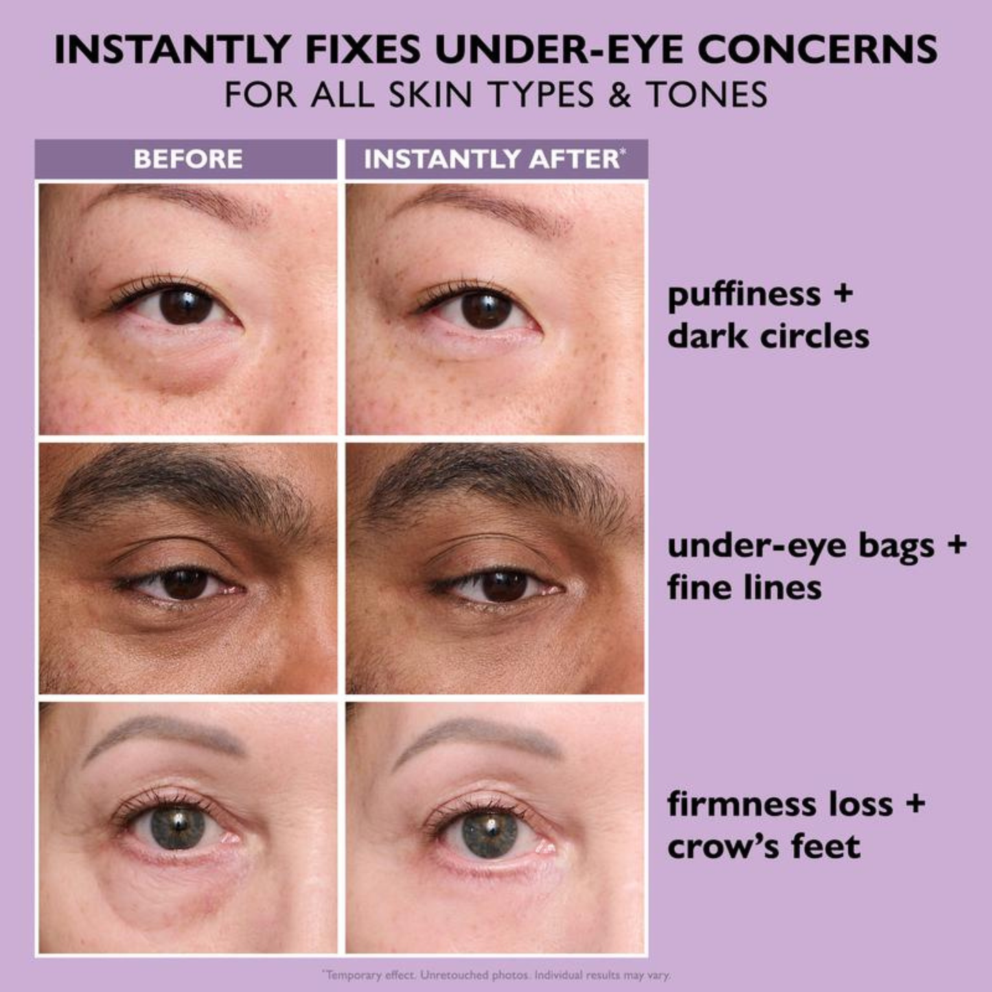 Eye Cream Tightener